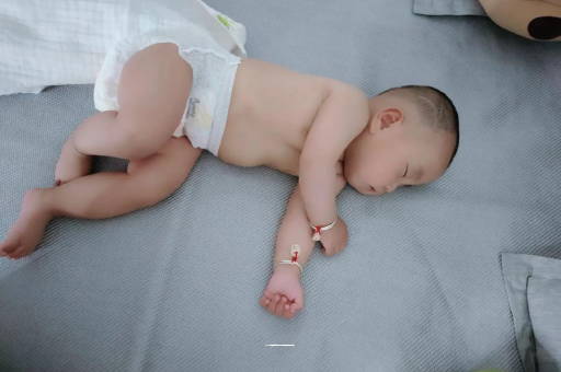 淮南六个月宝宝眼睛散光